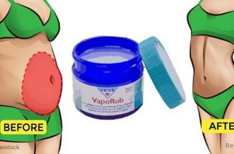 Vicks Vaporub: tanti usi che forse non conoscete